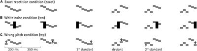 Auditory Pattern Representations Under Conditions of Uncertainty—An ERP Study